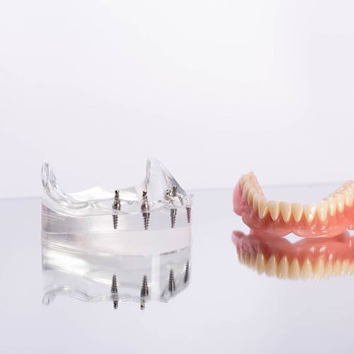 Dentist’s gloved hands at desk with X-rays, model teeth, and treatment plan paperwork