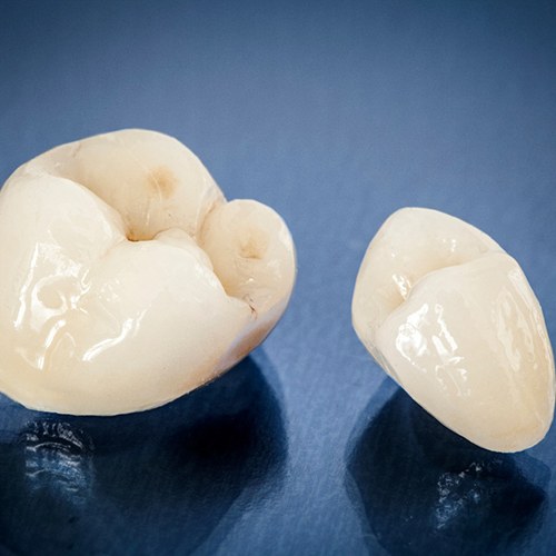 Close-up of two CEREC same-day dental crowns in Langley, WA